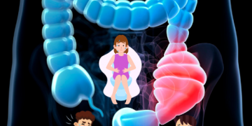 변비 종합 가이드