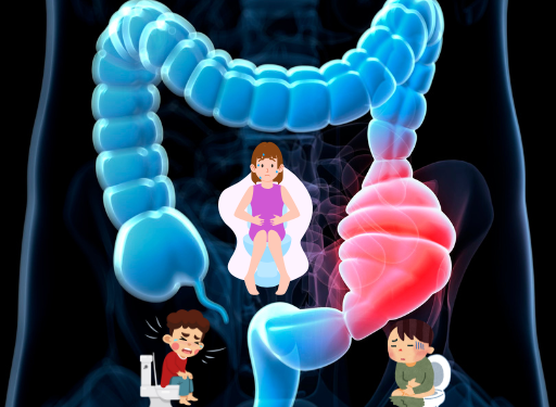 변비 종합 가이드