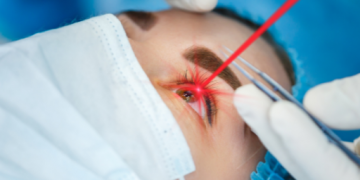 라식(LASIK) 수술이란?