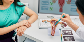 다낭성 난소 증후군